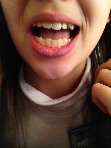 Teeth