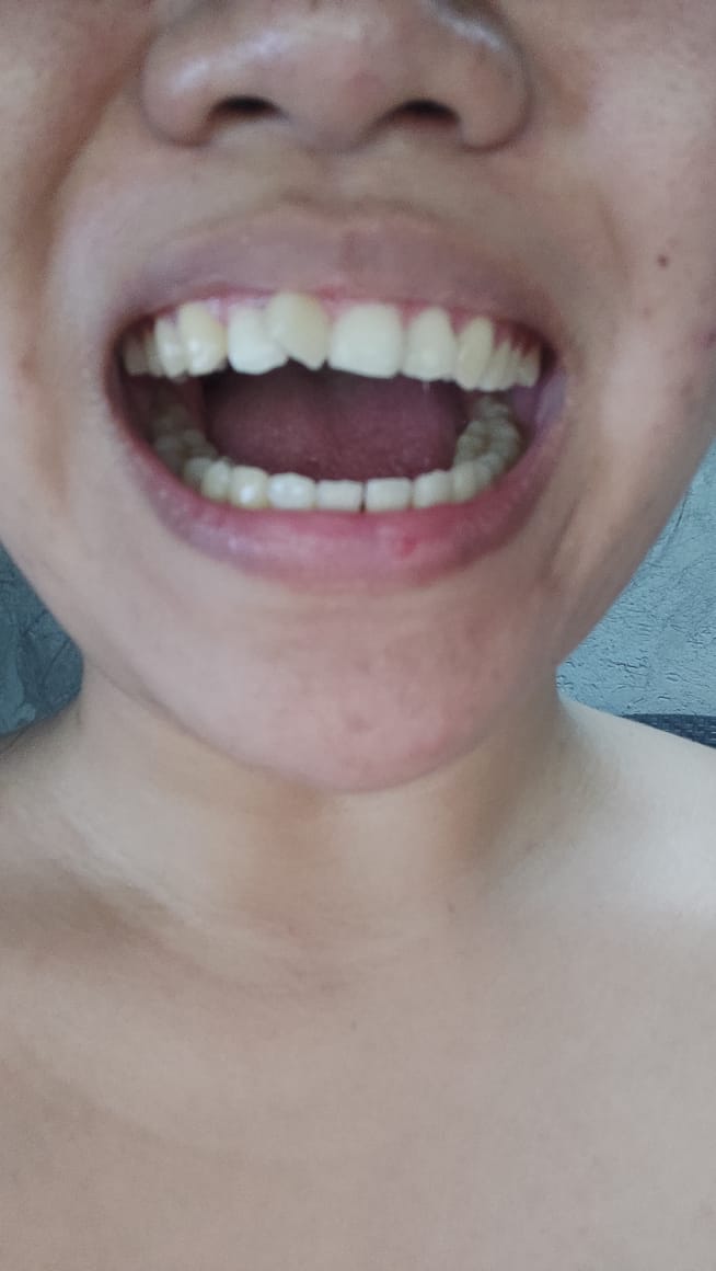Better Smile