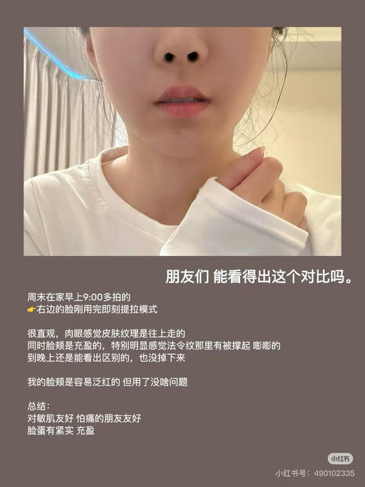 【4分钟快速提拉】喵总自用ziip hola，年度最低价，全站8折