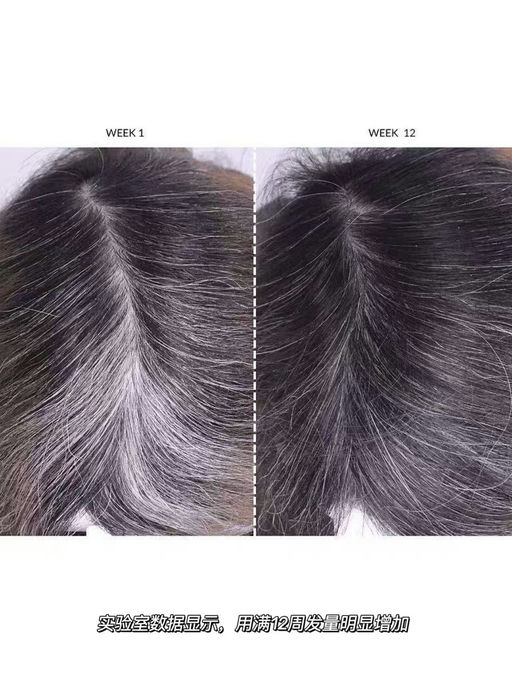 【喵总自用强推】CurrentBody健发帽，一年仅一次8折