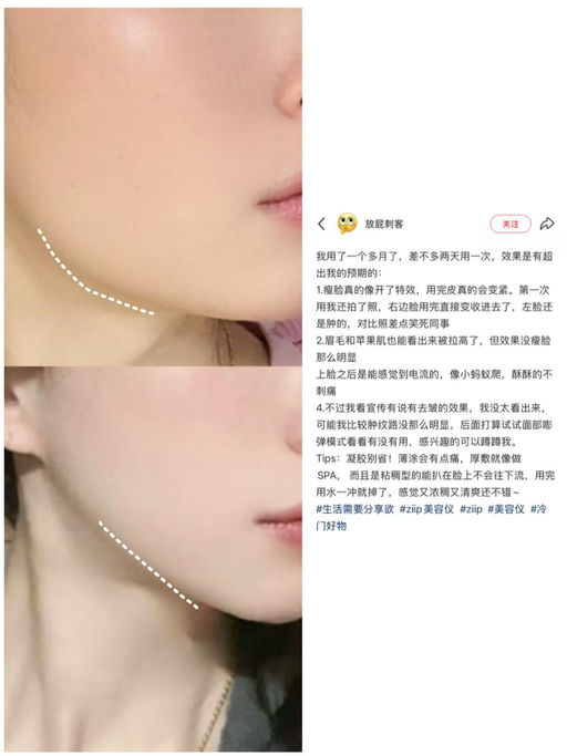 【4分钟快速提拉】喵总自用ziip hola，年度最低价，全站8折