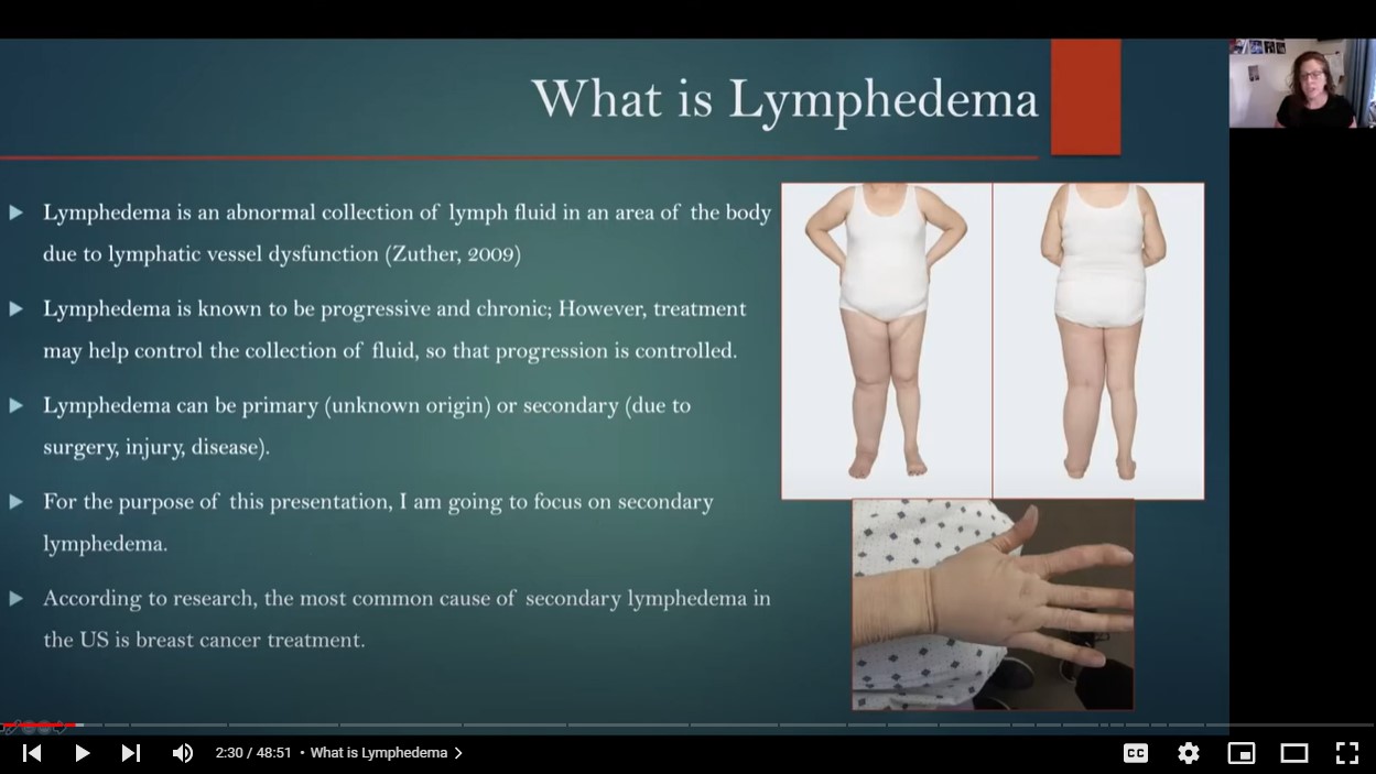 Lymphedema — What Is It and What Can Be Done About It?