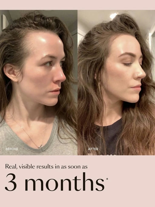 ➕【头发要长出来了】Vegamour 7折，套装参加