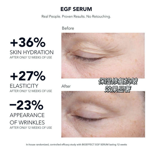 【干敏皮福音】7折，还送Face Roller+面霜