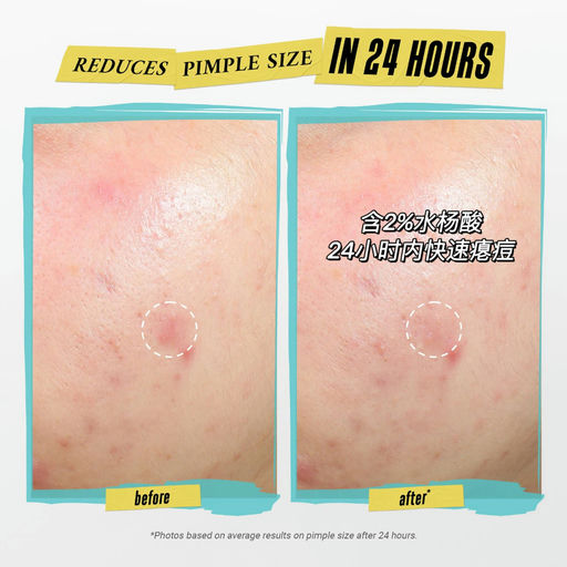 【刚上市就断货】隐形黑科技