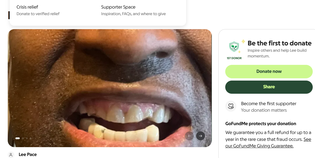 Help Restore My Smile and Confidence Today