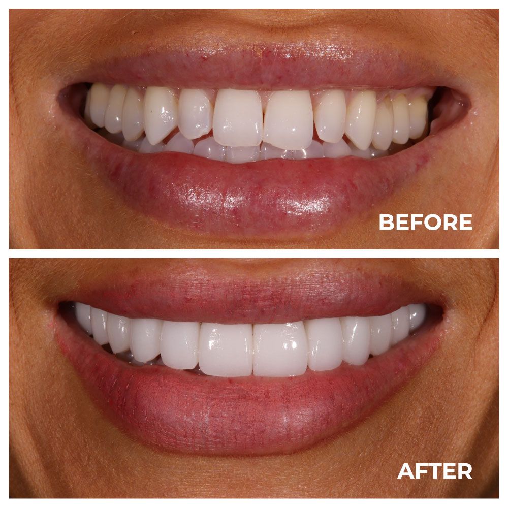 A man with a beard is wearing a white shirt and smiling with his arms crossed.