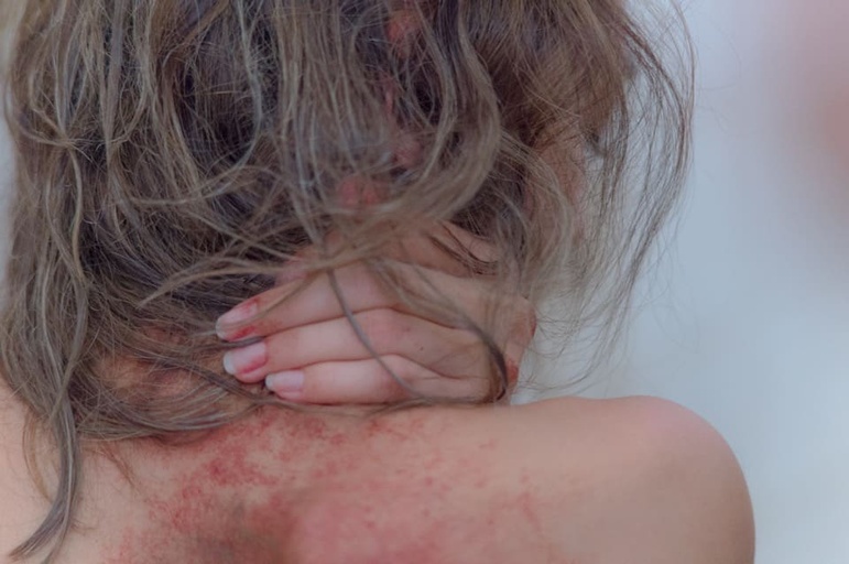 Courtesy of Mosquito Films Distribution