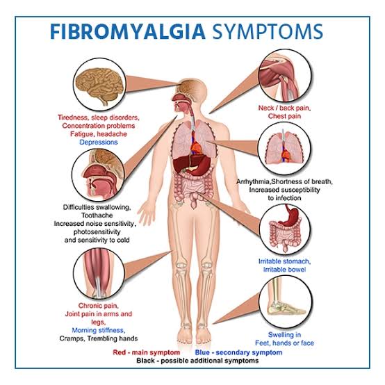Help me recover from fibromyalgia