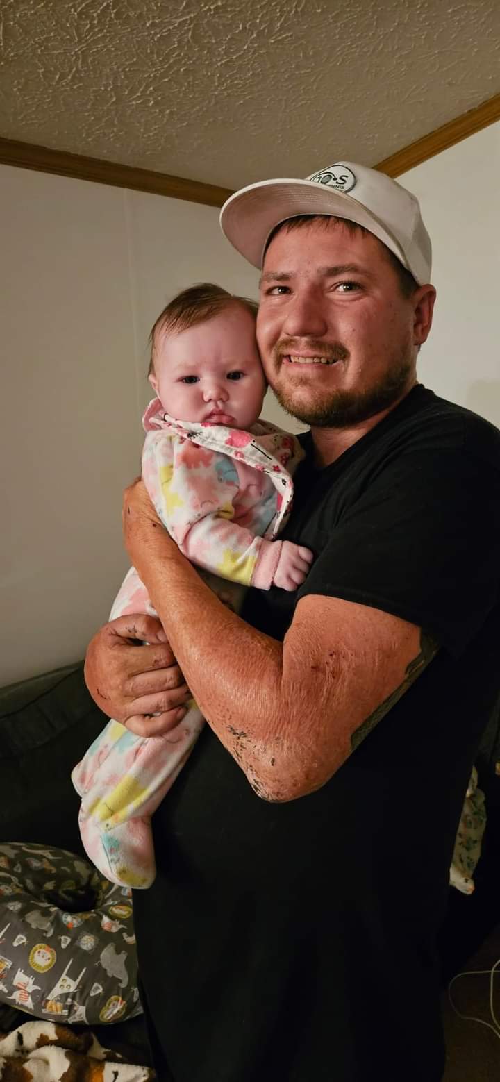 Burn survivor praying for a good life