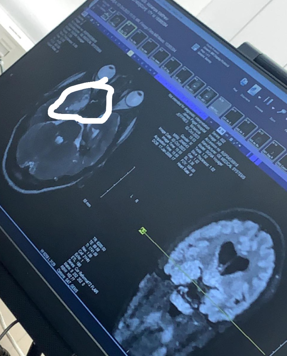 JAMES ARTHUR LIVE!!!