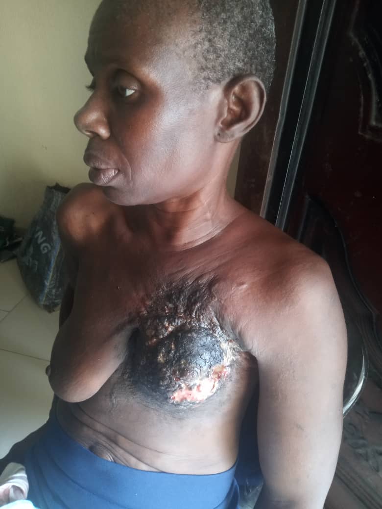 Medical Support for Poor mother of 5 Cancer Patient