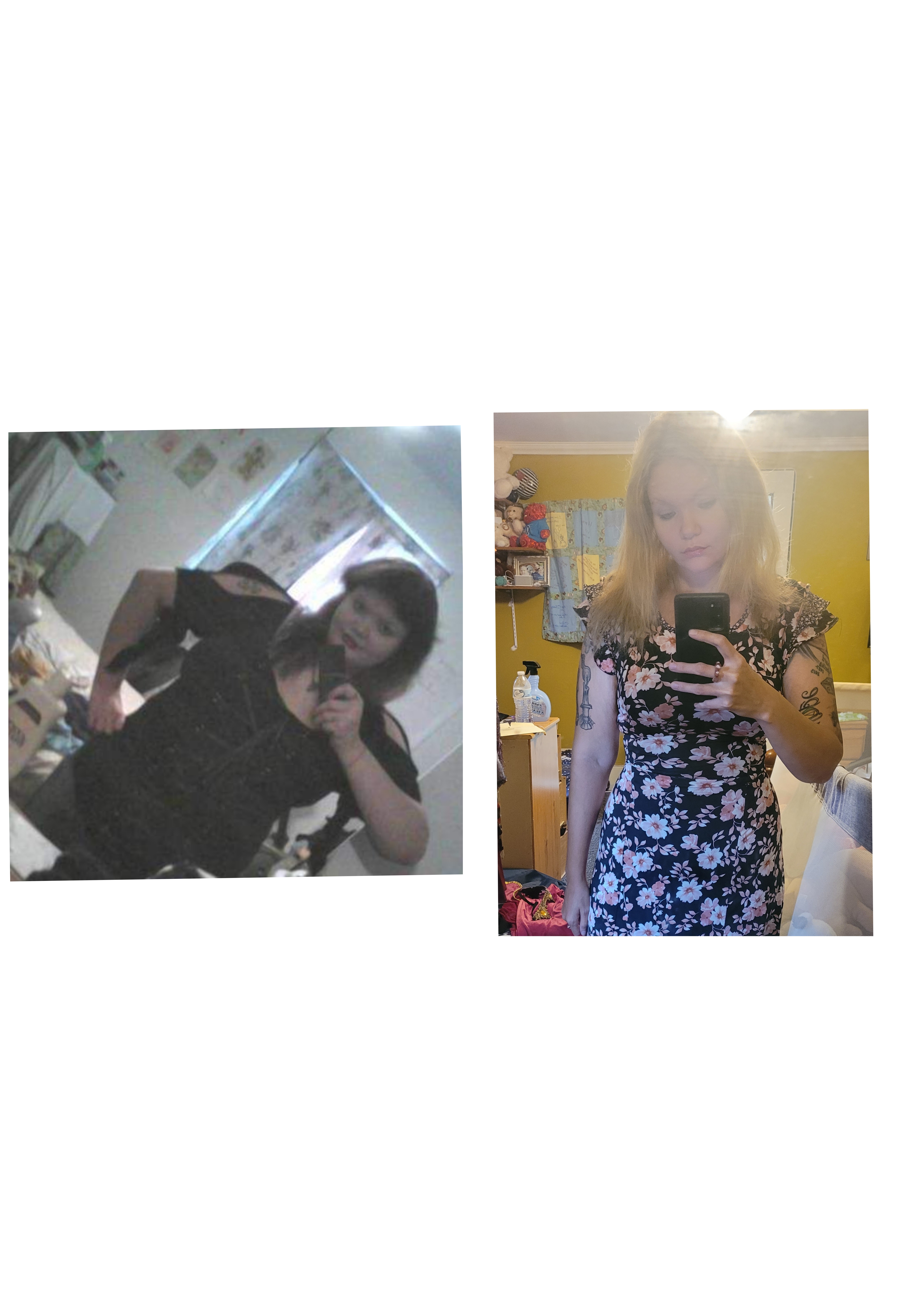 Community leader seeks to get a needed surgery