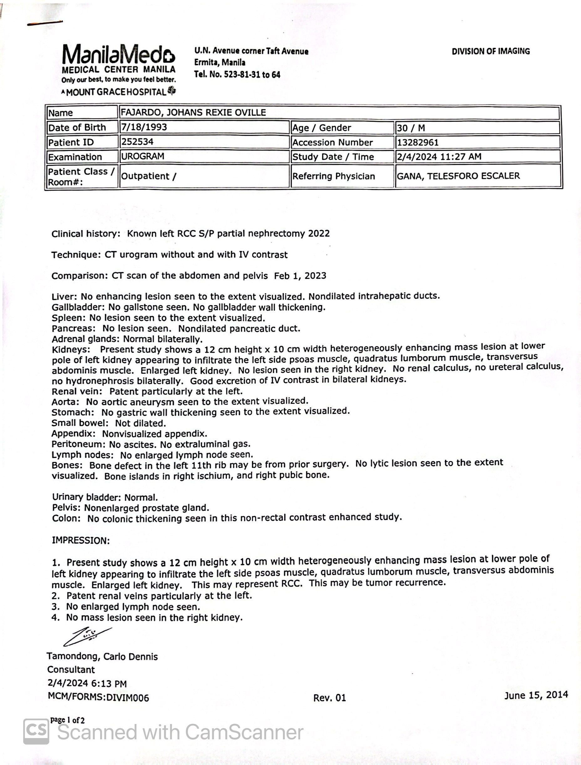 Renal Cell Cancer Surgery