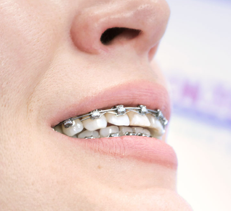 The dream of my whole life.