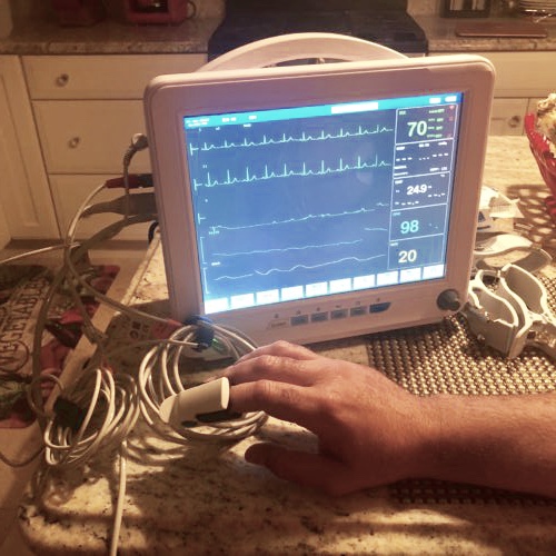 New EKG Machine For A Mobile Clinic: Wish Granted!