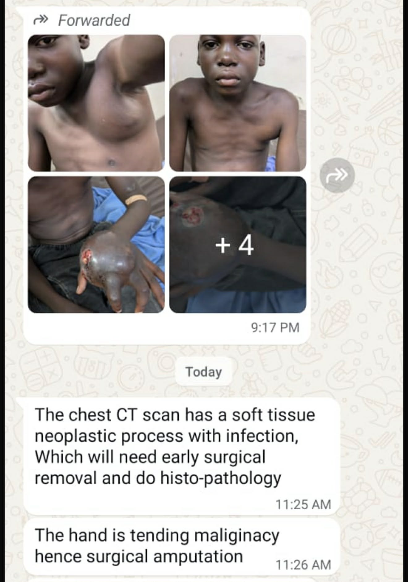 Help Bukenya Haruna get treatment