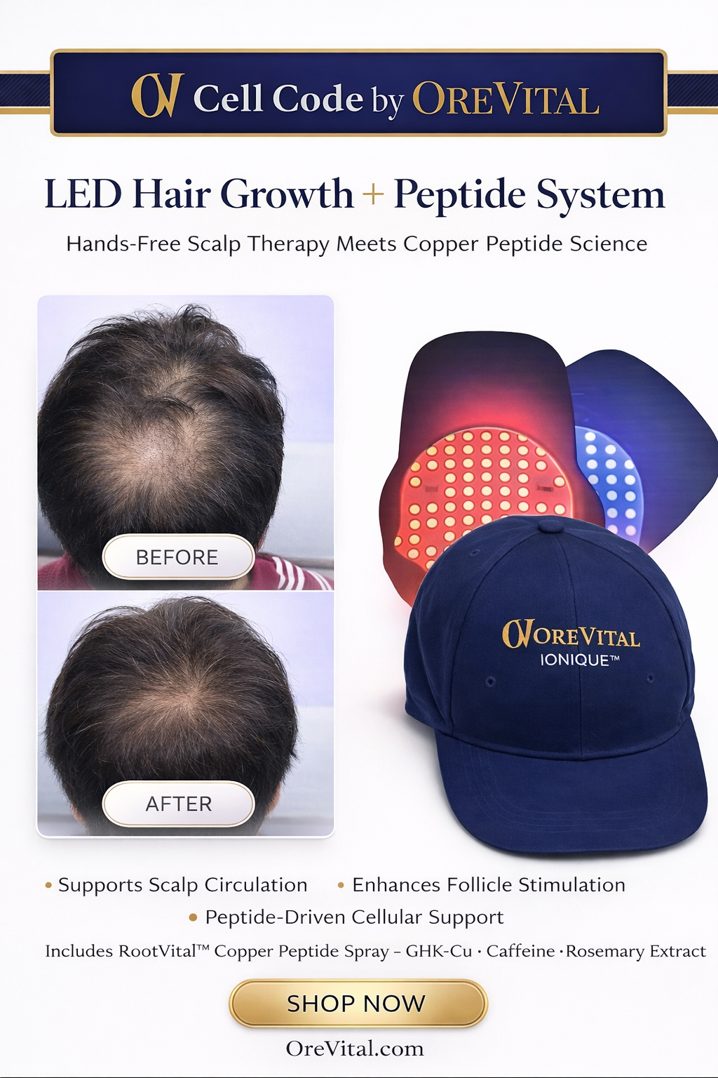 LED Cap & RootVital Hair Growth Bundle