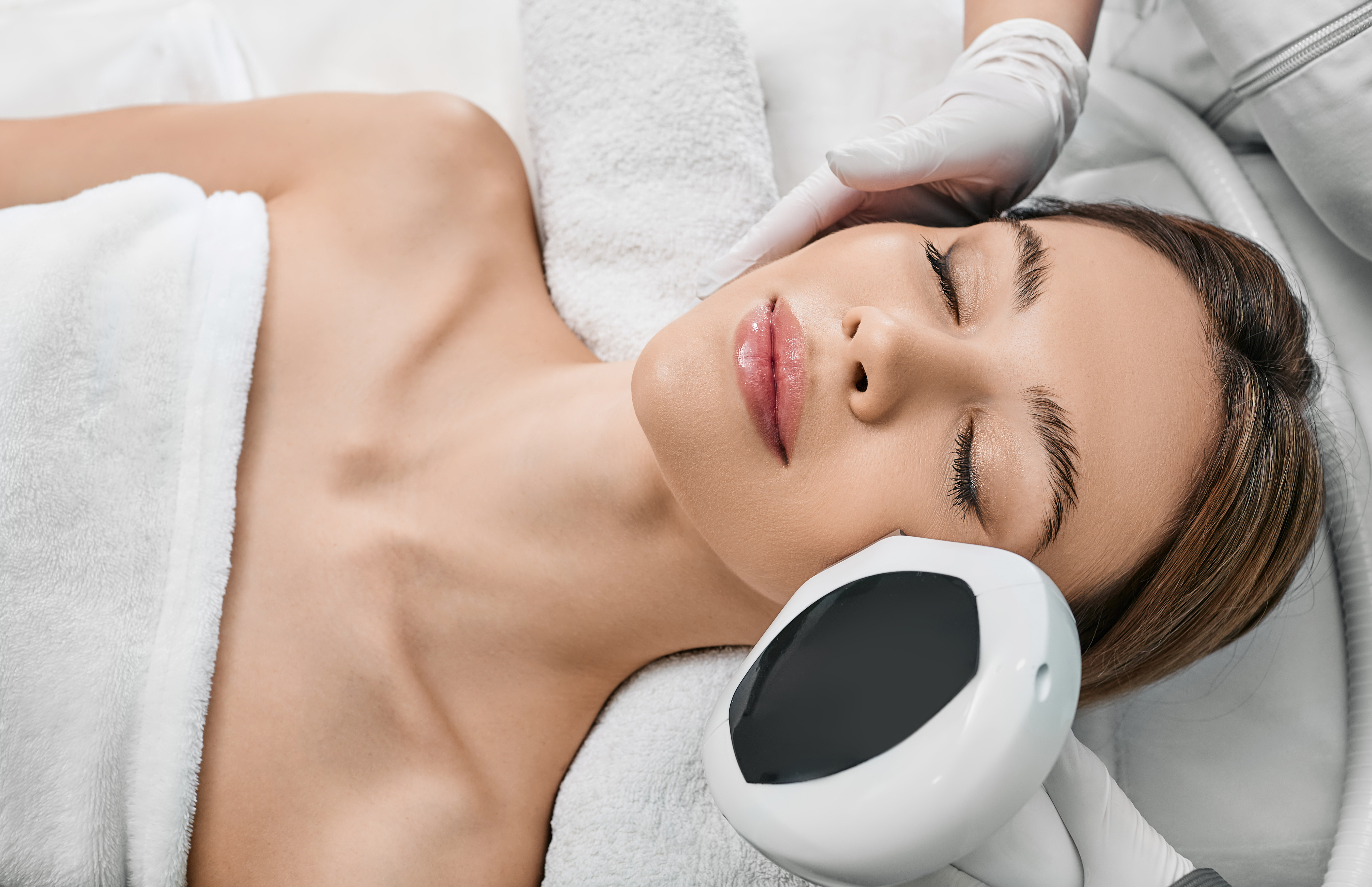 Lumecca IPL Photofacial