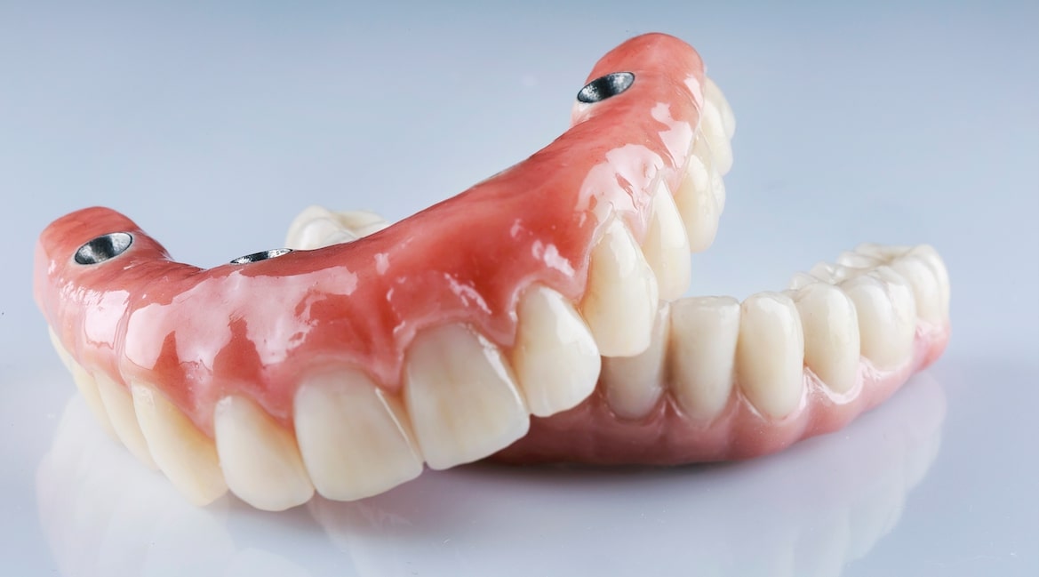Partials and Dentures