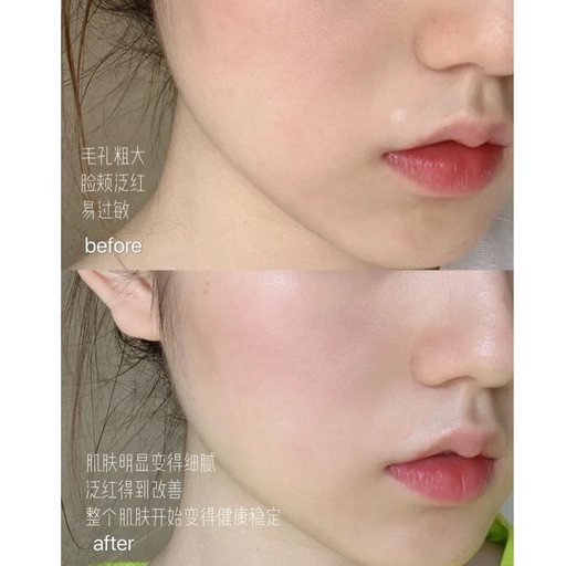 【小黑瓶5折】所有Size都参加