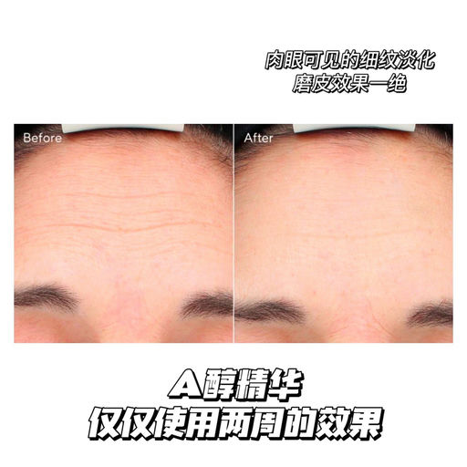 【1.8折！】90天换新肌