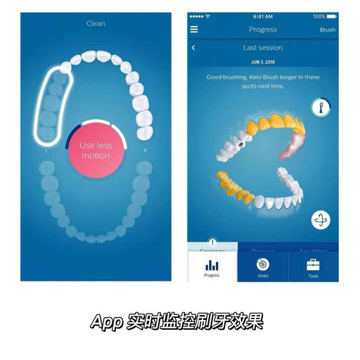 【史低回归】全球牙医推荐