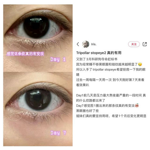 【618豪礼】下单就送$305 tripollar