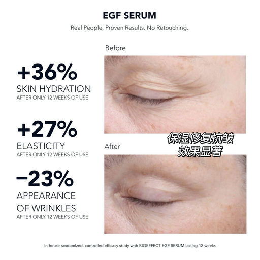 【58折】EGF史低+赠卡诗正装发油