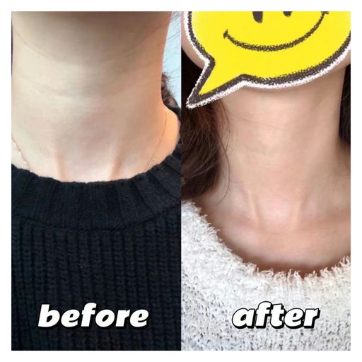 【时隔N月】医美级抗老