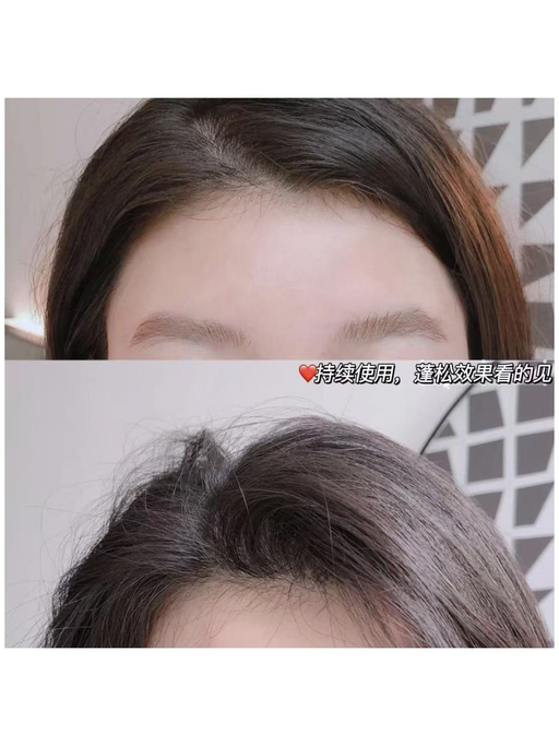 🪾【无门槛3折】【囤生发精华】  