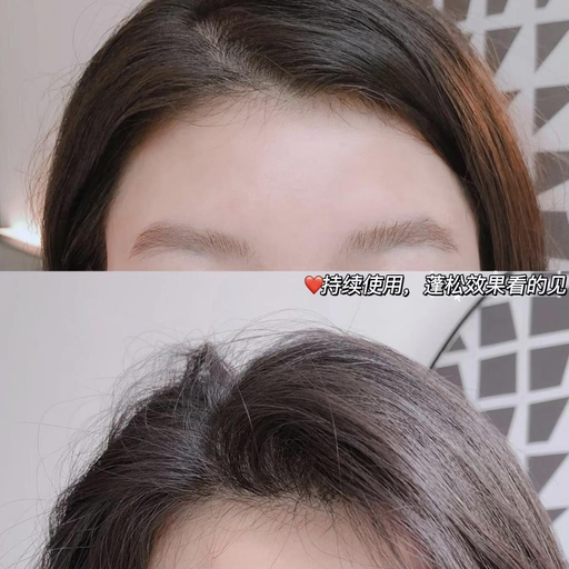 【一律2折】生发液$10