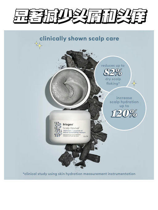 【小红书超多好评】【专治头顶油发尾枯】