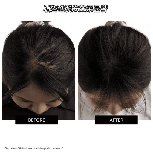 【年度最炸】Currentbody黑五开跑