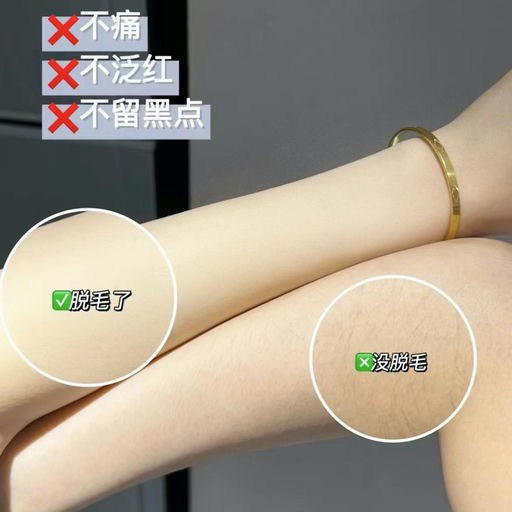 【从未有过史低！】Ulike，直降$100