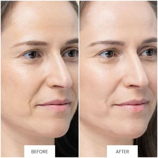 【极致神价！】Tripollar，22折