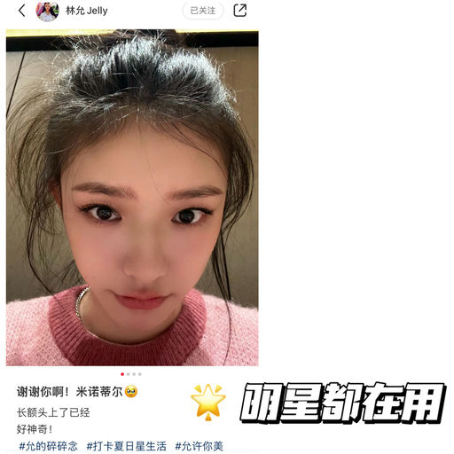 【发际线守护神】米诺地尔罕见折