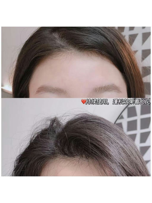 【生发液2折！】【$10，免运】