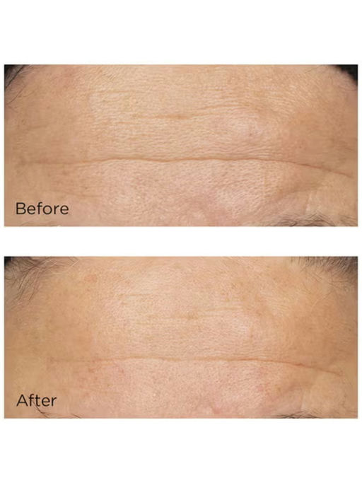 【绝了！】1.7折！！！