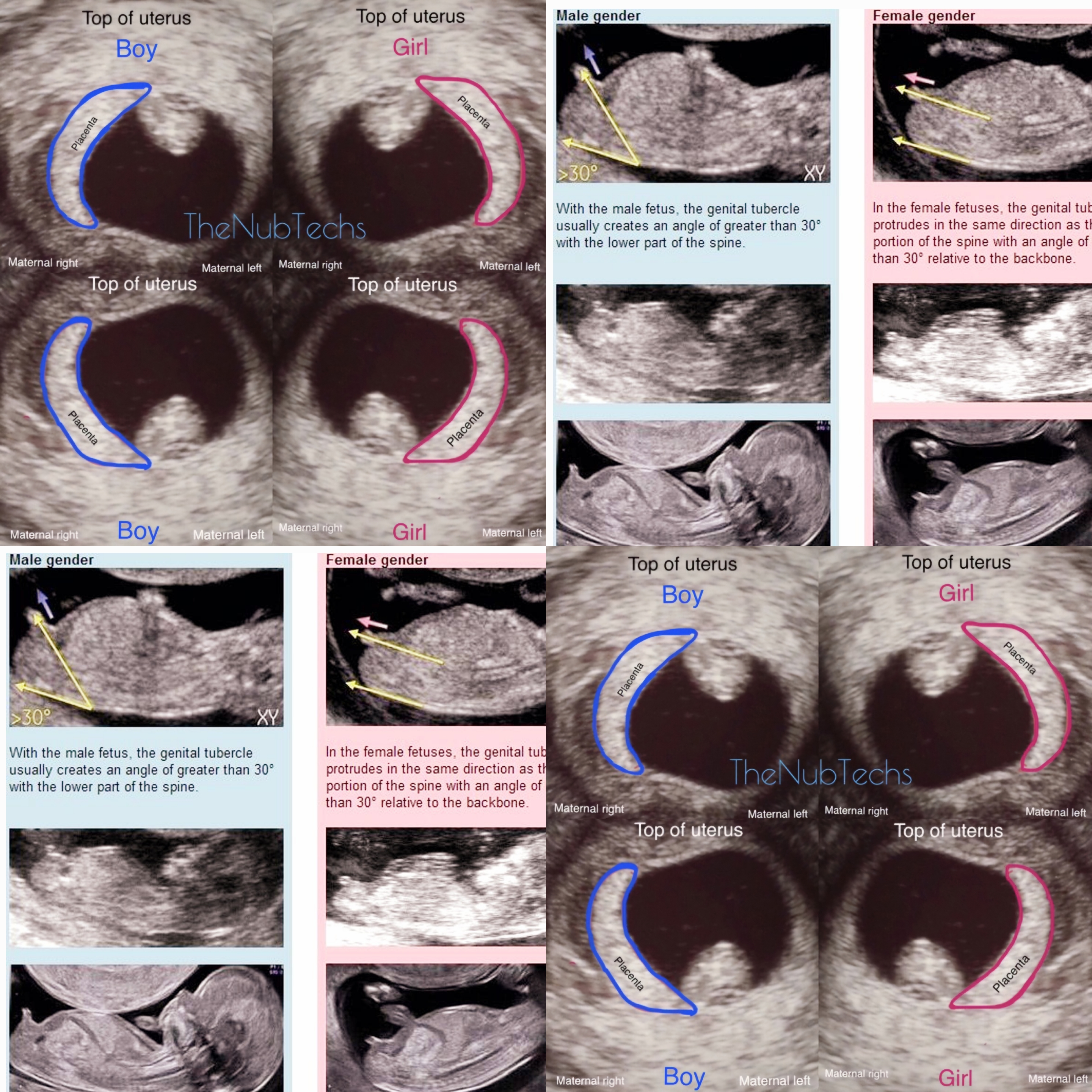 For Me In Order To Start My Long New Second Life Itself