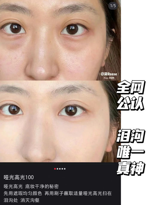 【泪沟神器】【$19，免运】