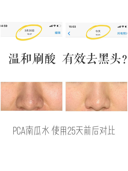 【PCA 全线8折】【南瓜水参加】