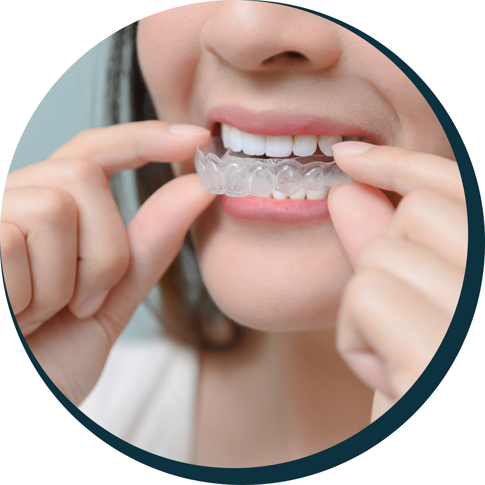 Occlusal & Sports Guards