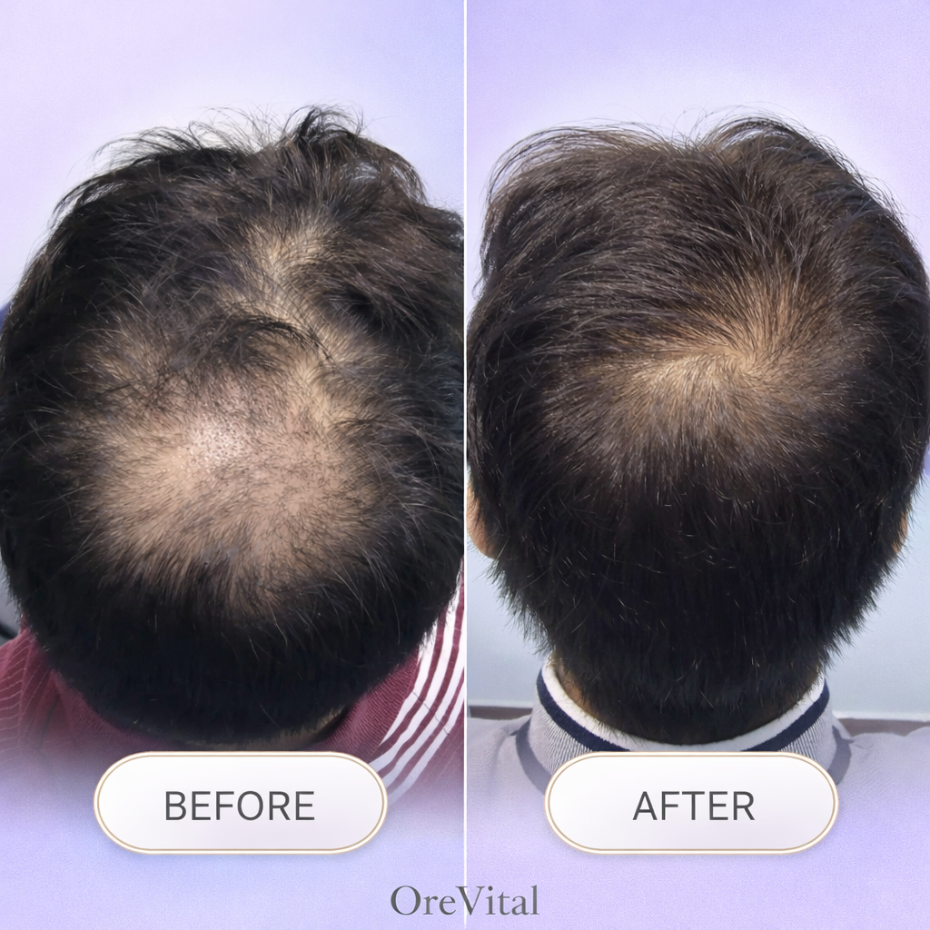 RootVital GHKU Peptide Hair Growth - Image 4
