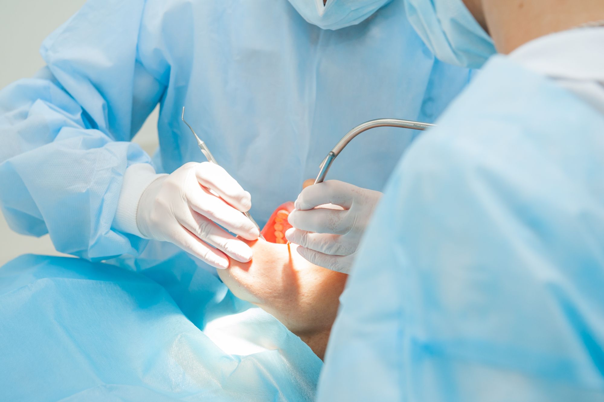 Tooth Extractions