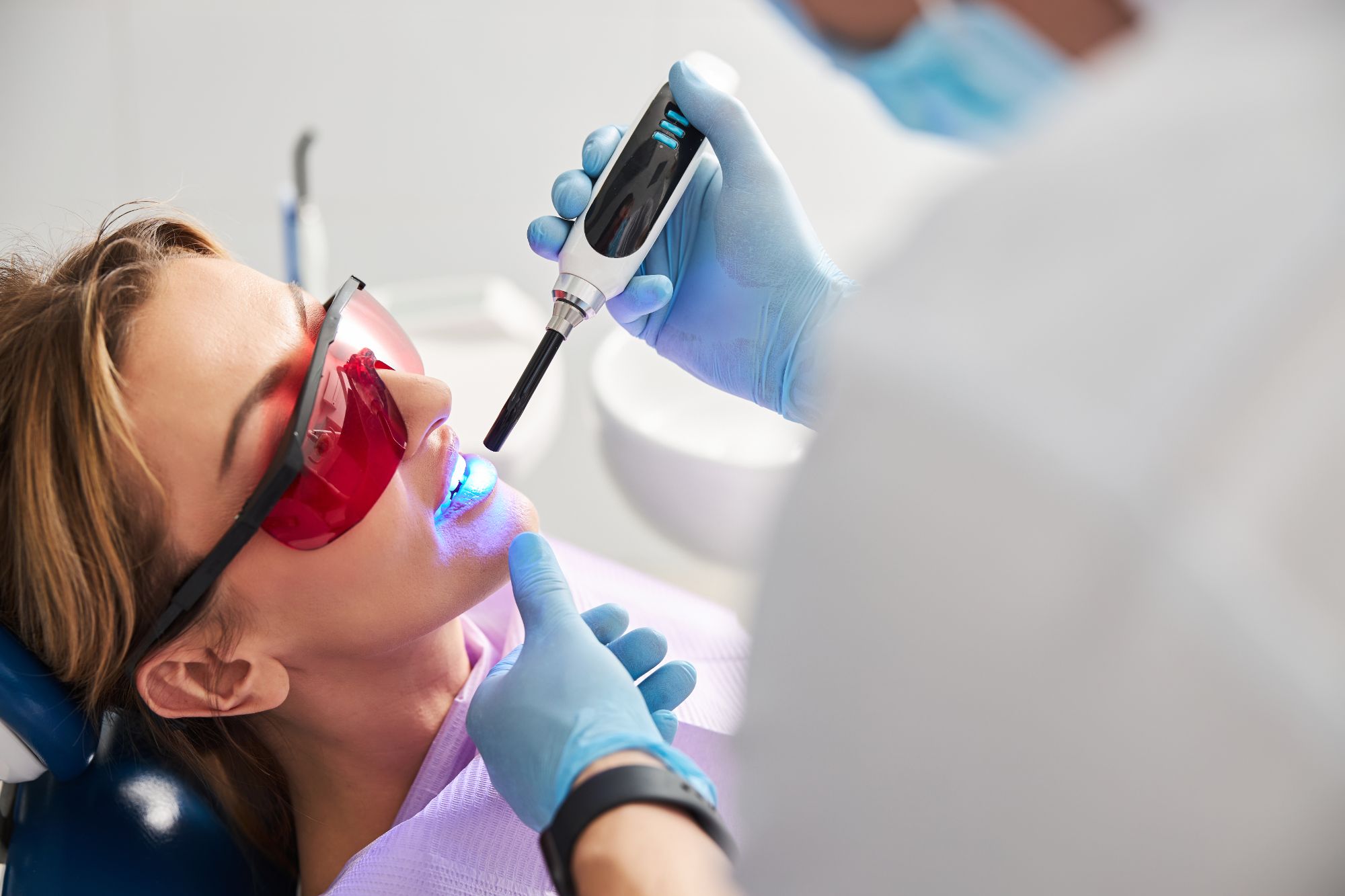 Sealants