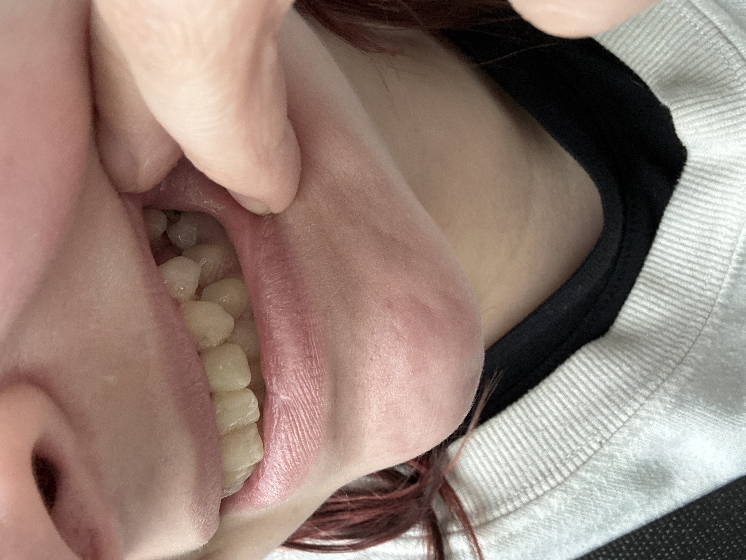 I want to smile again.